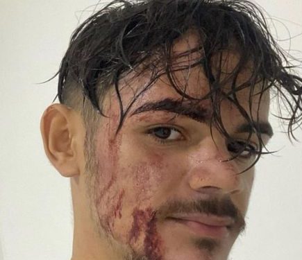 Cliente joga açaí em motoboy por atraso na entrega; trabalhador irá acionar a Justiça