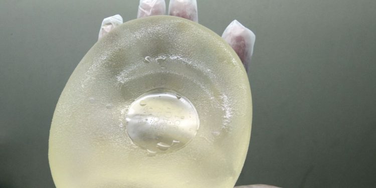 Lei garante troca de implante mamário para paciente de câncer