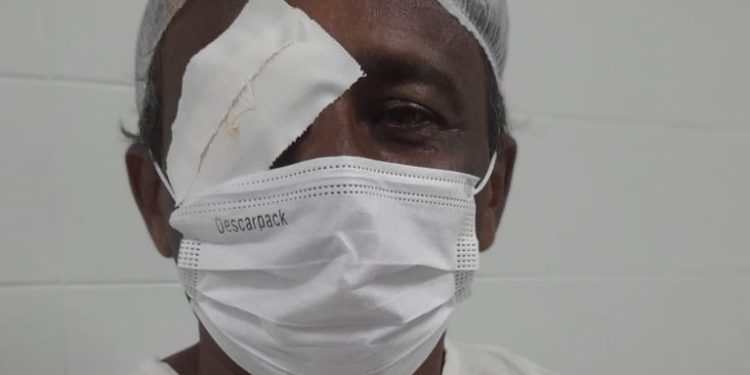 Opera Paraíba realiza mutirão de cirurgia de pterígio no Hospital de Clínicas de Campina Grande