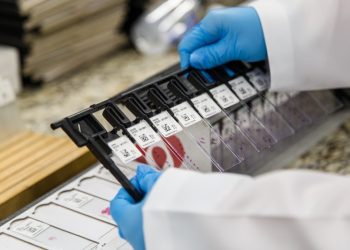 Brasil ganha laboratório de biologia molecular oncológica referência na América Latina