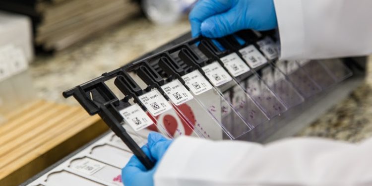 Brasil ganha laboratório de biologia molecular oncológica referência na América Latina