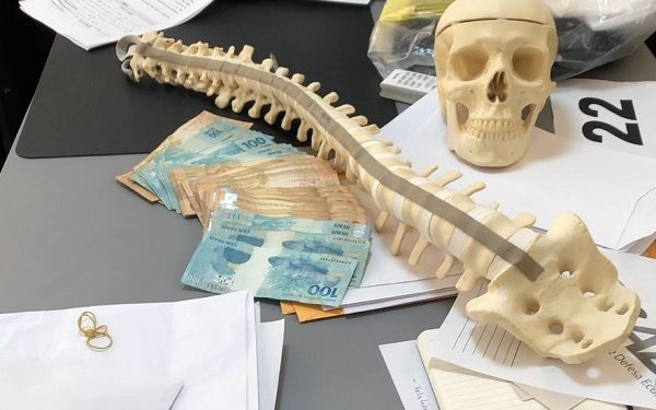 Escoliose: Operação do MPRN, Cade e Gaeco/MPPB apura formação de cartel para cirurgias ortopédicas