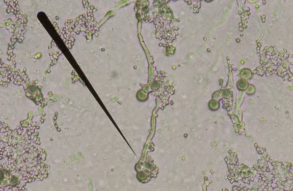 Projeto multicêntrico estudará fungos que causam infecções em hospitais no Nordeste