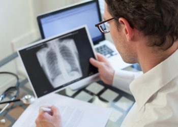 Tuberculose: a doença descoberta no século XIX pode ser prevenida, tem cura, mas ainda afeta 10 milhões de pessoas no mundo