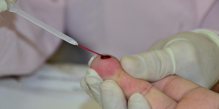 Prefeitura de João Pessoa oferece prevenção e tratamento da sífilis na Rede Municipal de Saúde