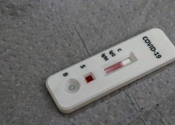Prefeitura da Capital disponibiliza teste rápido para detecção da Covid-19 nas unidades de saúde da família