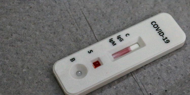 Prefeitura da Capital disponibiliza teste rápido para detecção da Covid-19 nas unidades de saúde da família