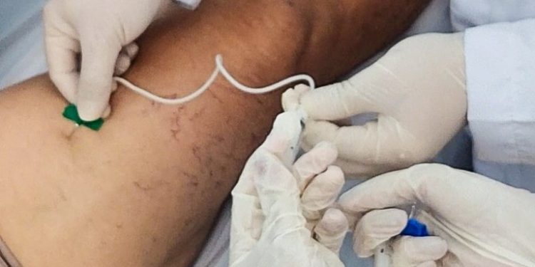Hospital Edson Ramalho realiza procedimento vascular com aplicação de espumas para tratamento de varizes