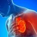 Doenças respiratórias típicas do inverno podem ser gatilhos para infartos
