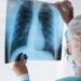 Patos recebe reconhecimento do Ministério da Saúde por alcançar 100% de cura nos casos de tuberculose pulmonar em 2024