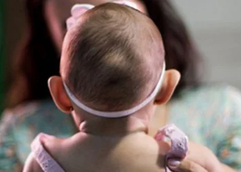 Lula assina medida que garante auxílio de R$ 60 mil a vítimas de zika congênita