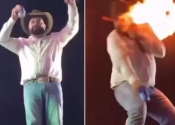 Vídeo: cantor mostra como ficou seu rosto após ser queimado durante show