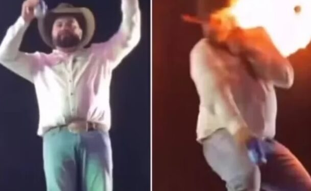 Vídeo: cantor mostra como ficou seu rosto após ser queimado durante show